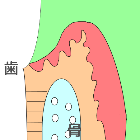 健康な歯の断面図