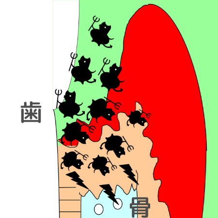 骨を溶かしている図